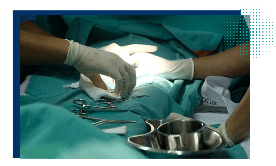 Manos con guantes en cirugía de circuncisión, bandejas e instrumental médico en quirófano – Urología en Naucalpan